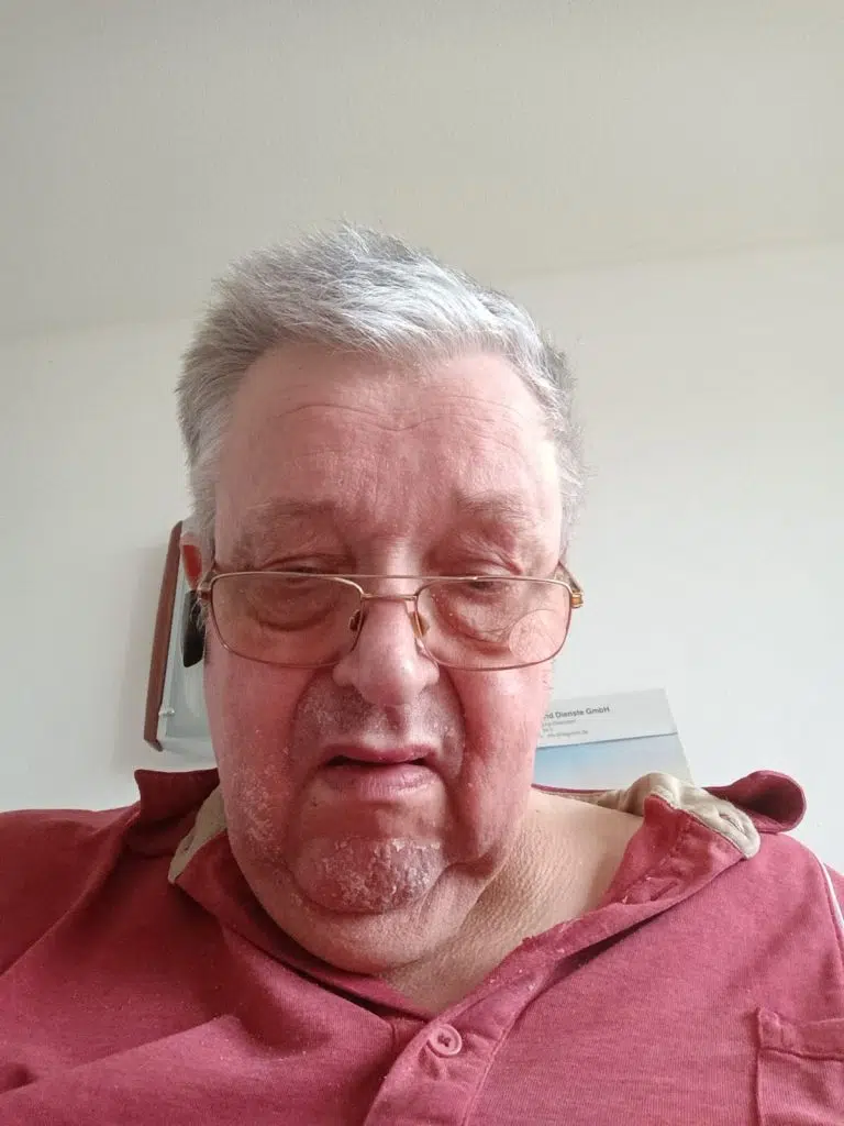 Rentner mit Handicap sucht Sexpartnerin